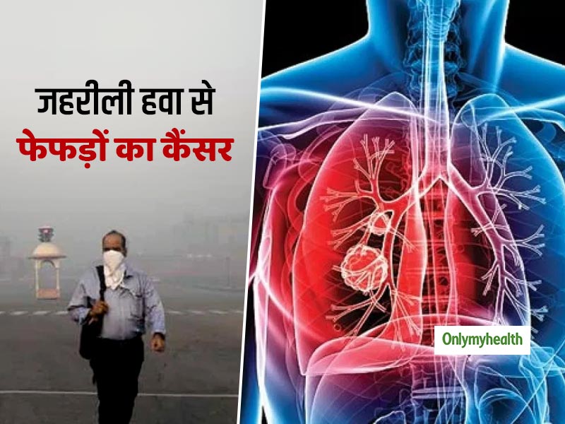 दिल्ली की जहरीली हवा से 28 साल की लड़की को हुआ फेफड़ों का कैंसर, डॉक्टर ने बताई ये वजह